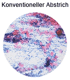 Abstrich_01